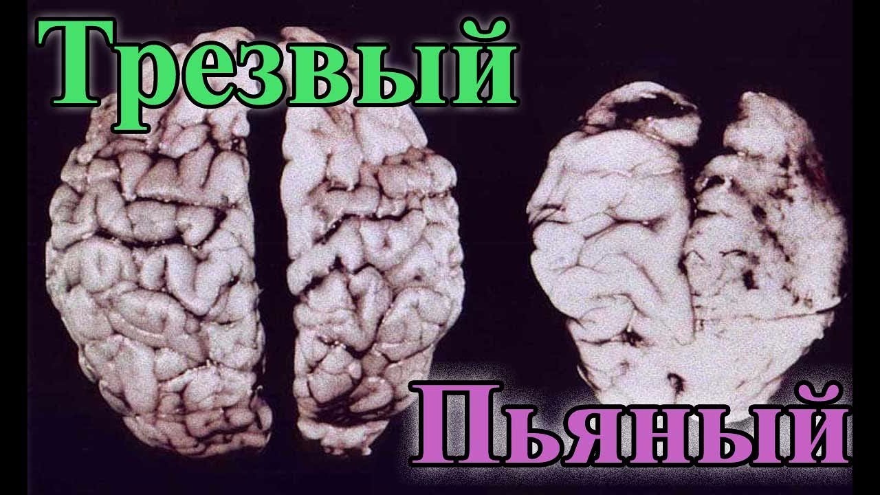 Запретим производство, продажу и распитие Водки в Владивостоке